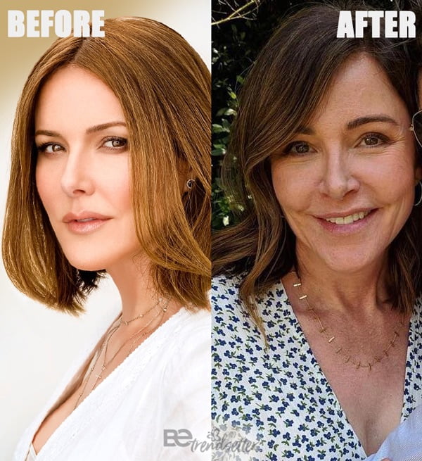 Christa Miller plastic surgery