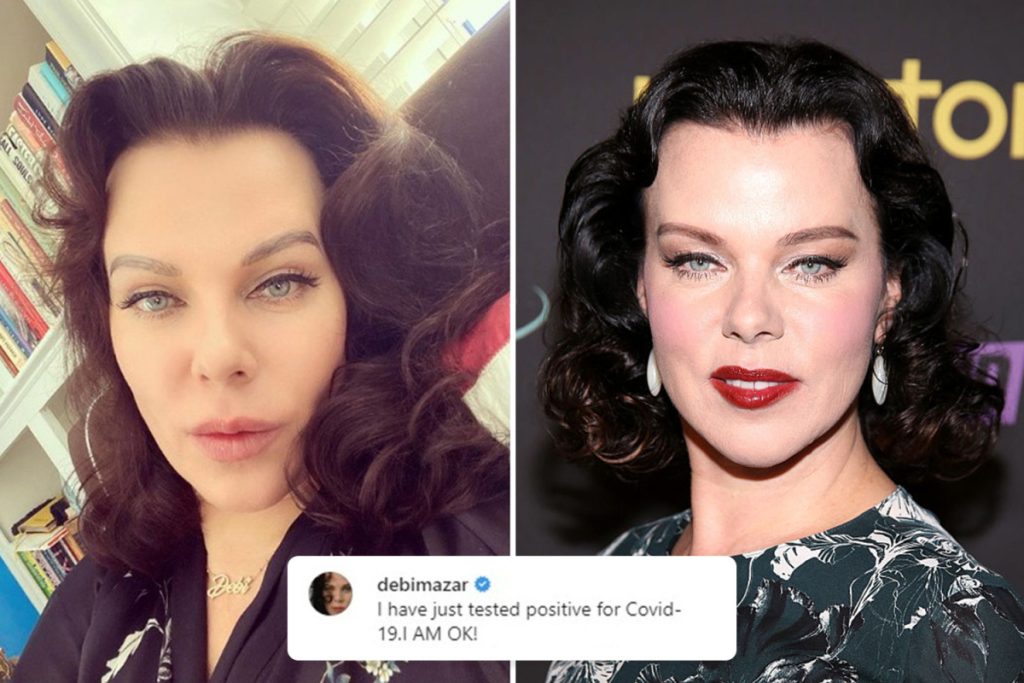 Debi Mazar lip fillers