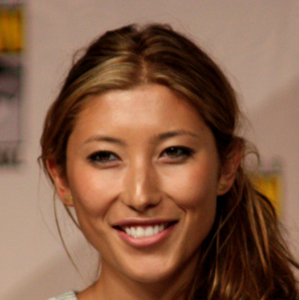 Dichen Lachman facelift