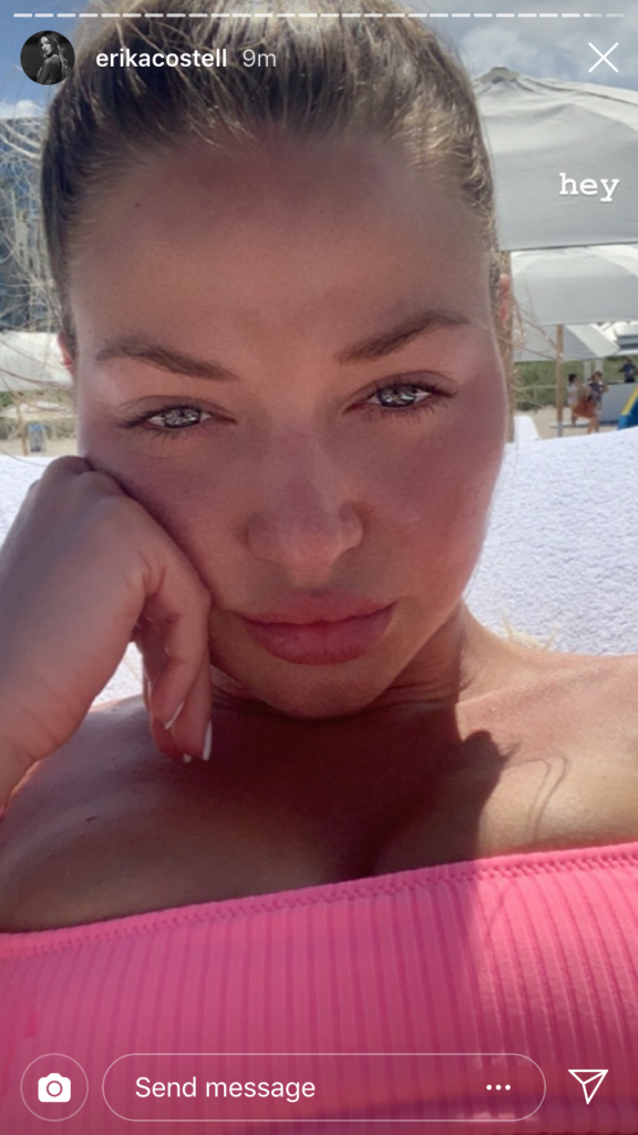 Erika Costell nose job