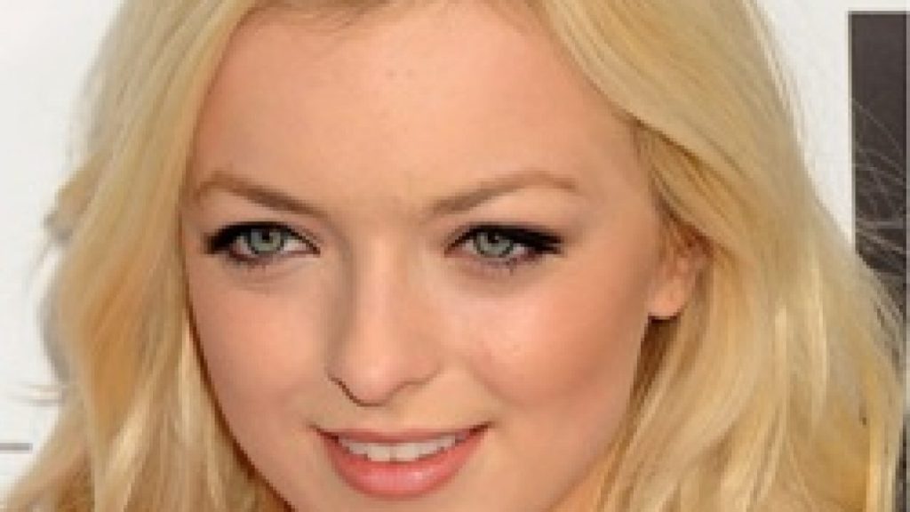 Francesca Eastwood lip fillers