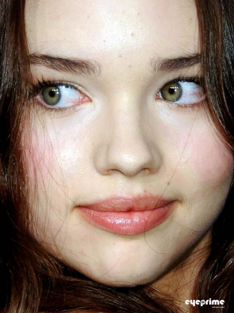 India Eisley plastic surgery