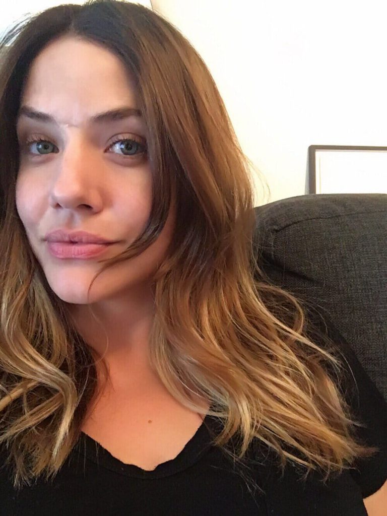 Julie Gonzalo botox