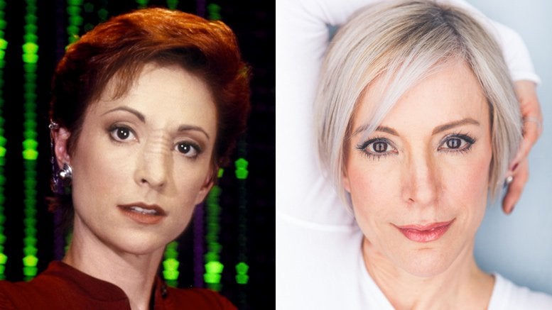 Nana Visitor nose job