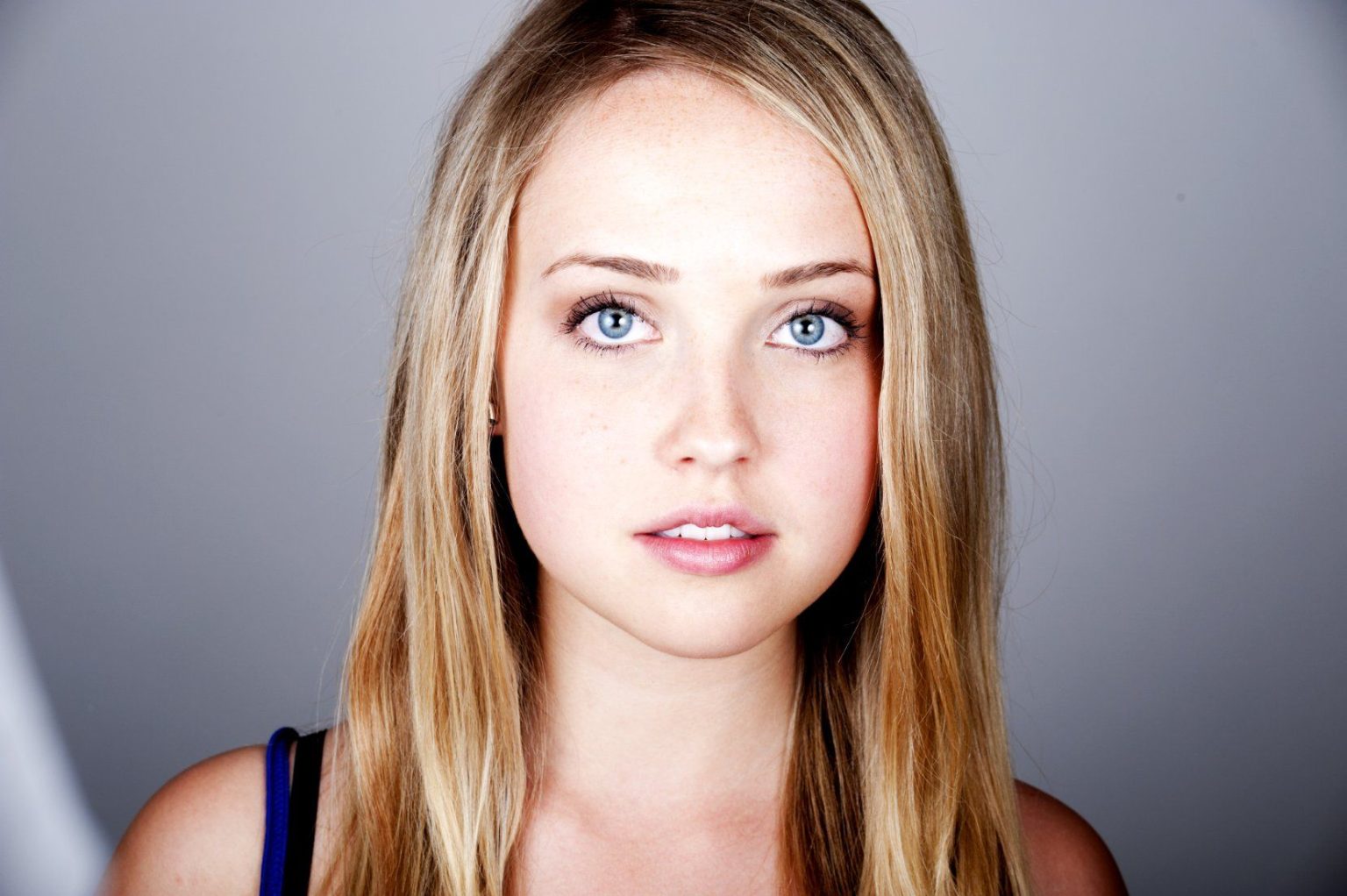 Siobhan Williams Plastic Surgery Before and After. Nose Job, Lips