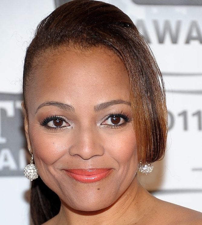 Kim Fields Plastic Surgery