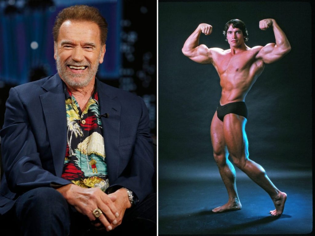 Arnold Schwarzenegger Cosmetic Surgery Body